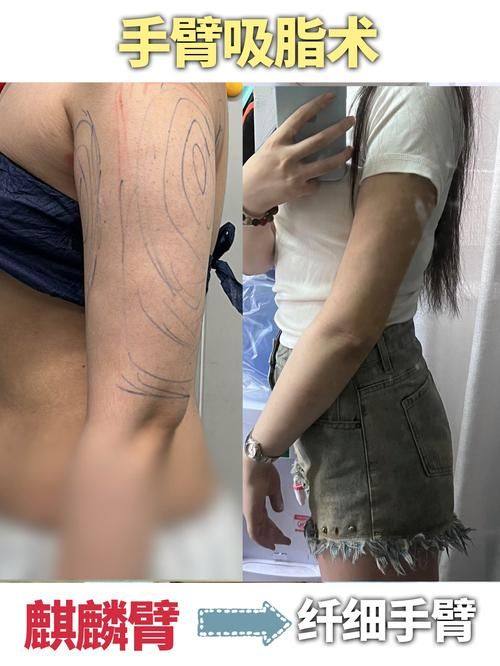 广州美莱医学美容医院地址电话营业时间