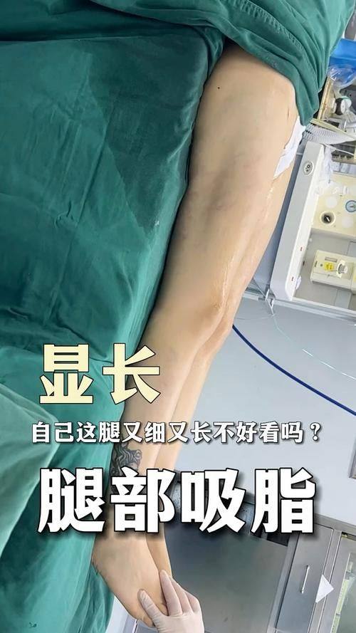 常州虹雅医疗美容诊所详细的预约挂号方式及流程