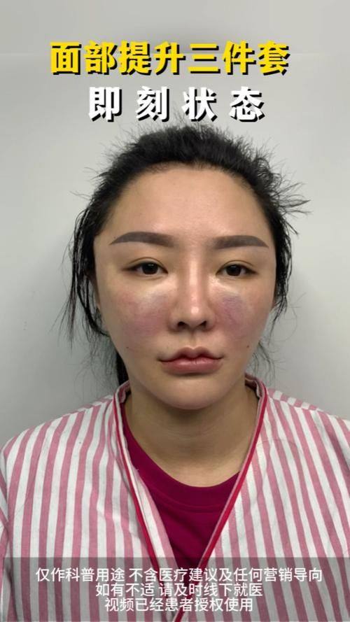 常州虹雅医疗美容诊所特色项目及技术优势