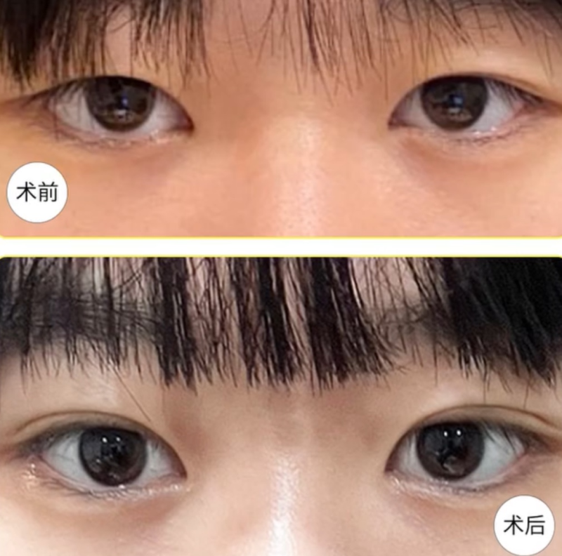 日照莒县汝颜轩铭整形医院地址电话营业时间