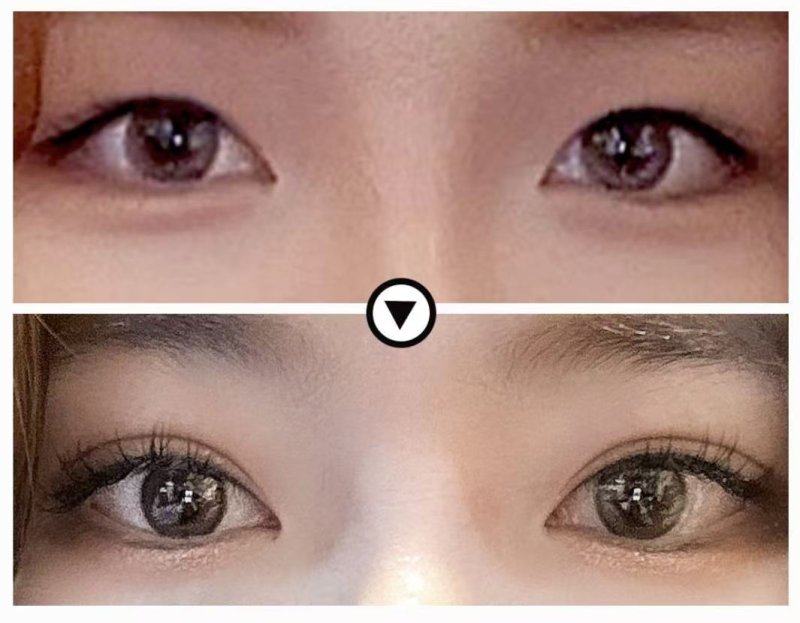 日照莒县汝颜轩铭整形医院详细的预约挂号方式及流程