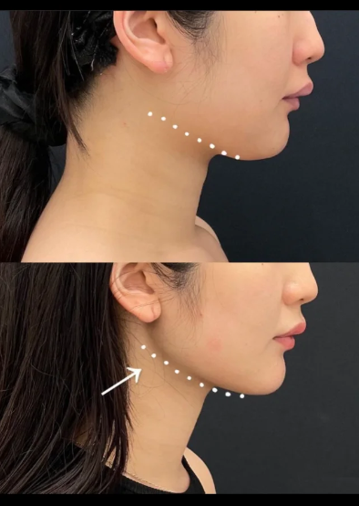 日照莒县汝颜轩铭整形医院是正规医院吗？