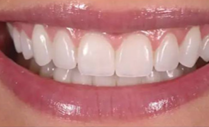 重庆晶皓口腔收费价格表/收费标准