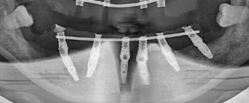 惠水县人民医院真人口碑评价怎么样？