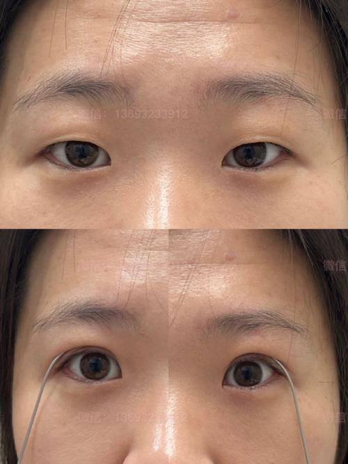 秦皇岛琪媛整形医院特色项目及技术优势