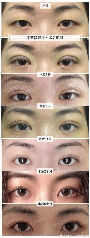 秦皇岛琪媛整形医院收费价格表/收费标准