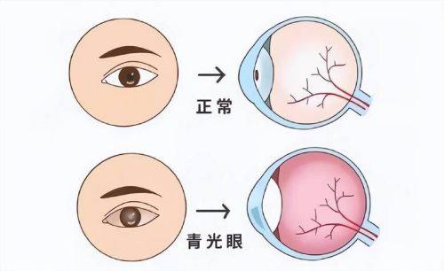 广州达达眼科视光门诊部真人口碑评价怎么样?