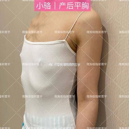 秦皇岛琪媛整形医院真人口碑评价怎么样？