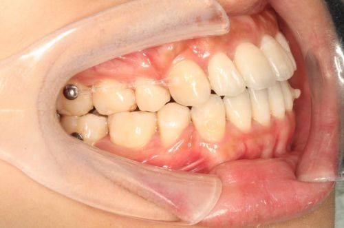 北京维乐口腔（花园路店）是正规医院吗？