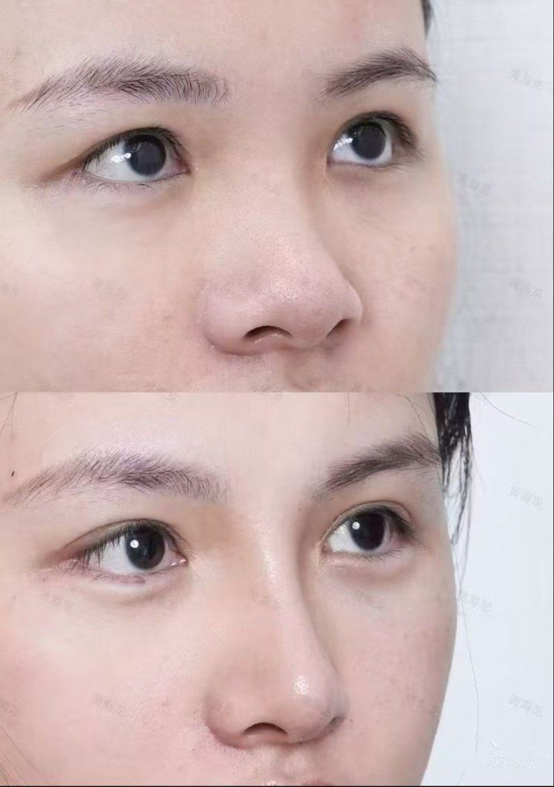 秦皇岛琪媛整形医院详细的预约挂号方式及流程