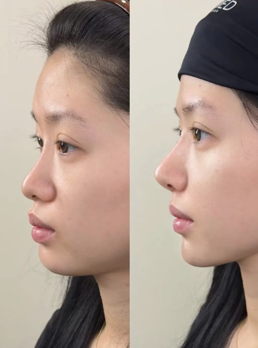 华韩(海南)整形美容医院有限公司是正规医院吗?