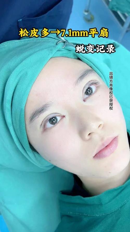 杭州臻珠医疗美容诊所真人口碑评价怎么样?