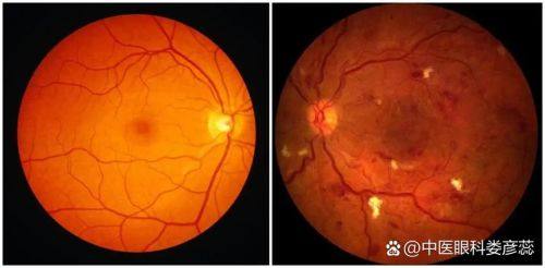 准格尔旗中蒙医院特色项目及技术优势