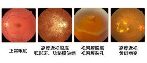 邵武市立医院眼科医生团队实力强大及骨干医生简介