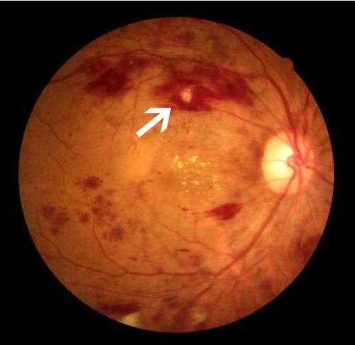 邵武市立医院眼科收费价格表/收费标准