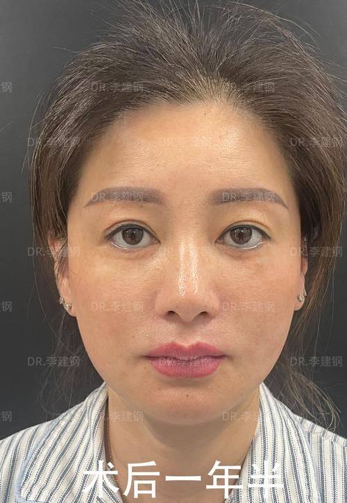 杭州臻珠医疗美容诊所医生团队实力强大及骨干医生简介