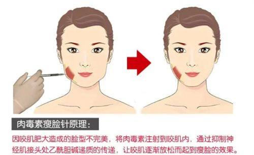 常德芯美昕医疗美容门诊部收费价格表/收费标准