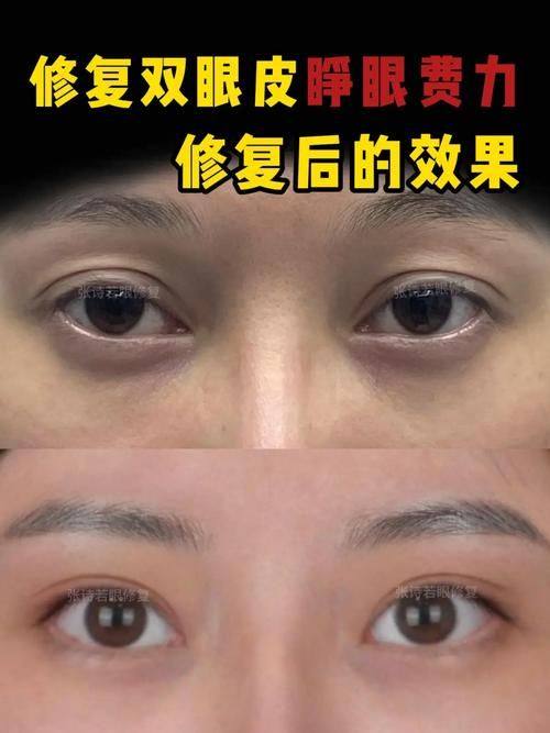 山东中 医 药研究院附属医院整形外科收费价格表/收费标准