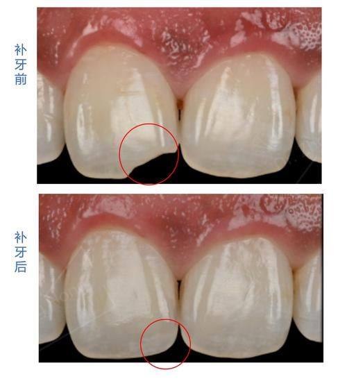 河南郑州悦好口腔详细的预约挂号方式及流程