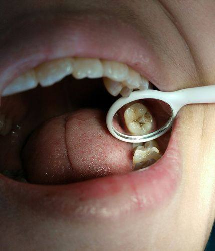 呼和浩特市少伟口腔特色项目及技术优势