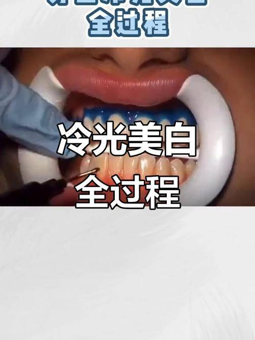 阳城小苹果口腔门诊部特色项目及技术优势