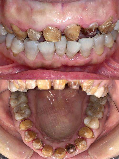 中山雅齐口腔真人口碑评价怎么样?