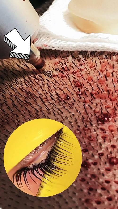 厦门思明碧莲盛整形外科门诊部医生团队实力强大及骨干医生简介