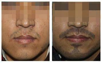 厦门思明碧莲盛整形外科门诊部收费价格表/收费标准