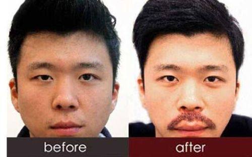 厦门思明碧莲盛整形外科门诊部特色项目及技术优势