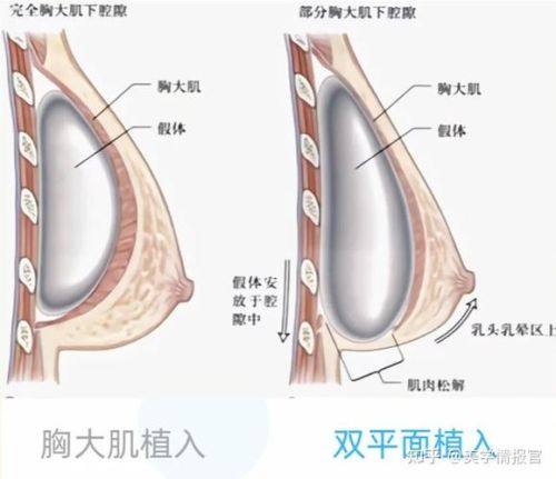 江阴兰积整形医院真人口碑评价怎么样?