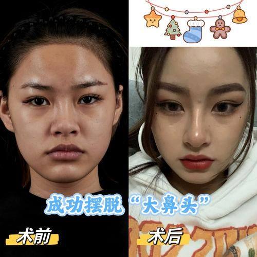 韩国新帝瑞娜（灰姑娘）整形外科特色项目及技术优势