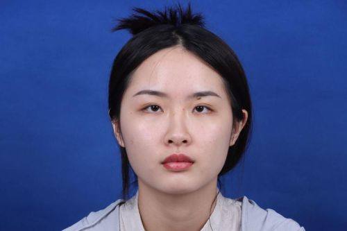 上海昕伊颜医疗美容门诊部是正规医院吗？