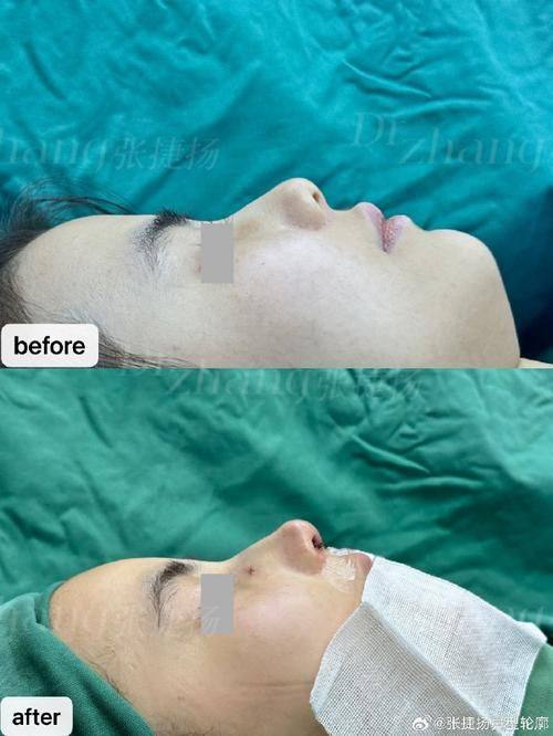 韩国新帝瑞娜（灰姑娘）整形外科真人口碑评价怎么样？