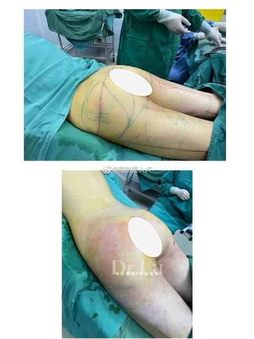 雷波美枢整形医院地址电话营业时间