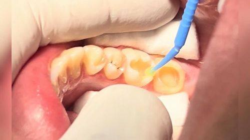 杭州明嘉齿科医生团队实力强大及骨干医生简介