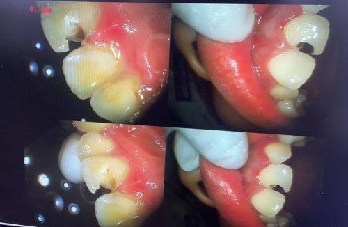 安徽淮北于钦睿口腔详细的预约挂号方式及流程