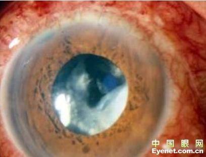 河北北方学院附属第二医院真人口碑评价怎么样?