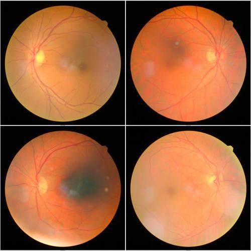 河北北方学院附属第二医院详细的预约挂号方式及流程