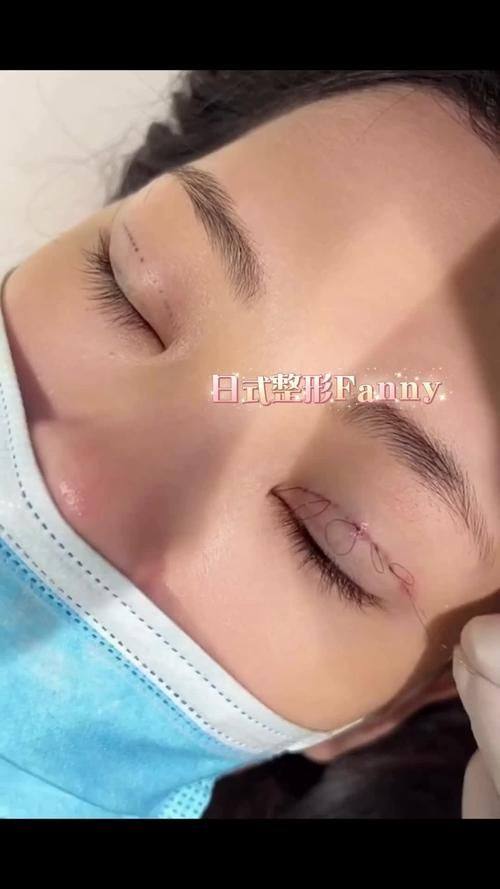 雷波美枢整形医院详细的预约挂号方式及流程