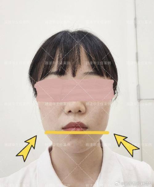 韩国新帝瑞娜（灰姑娘）整形外科是正规医院吗？