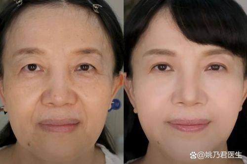 上海昕伊颜医疗美容门诊部收费价格表/收费标准