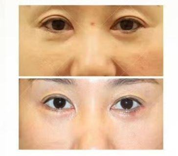 河南星韵医疗美容诊所真人口碑评价怎么样？