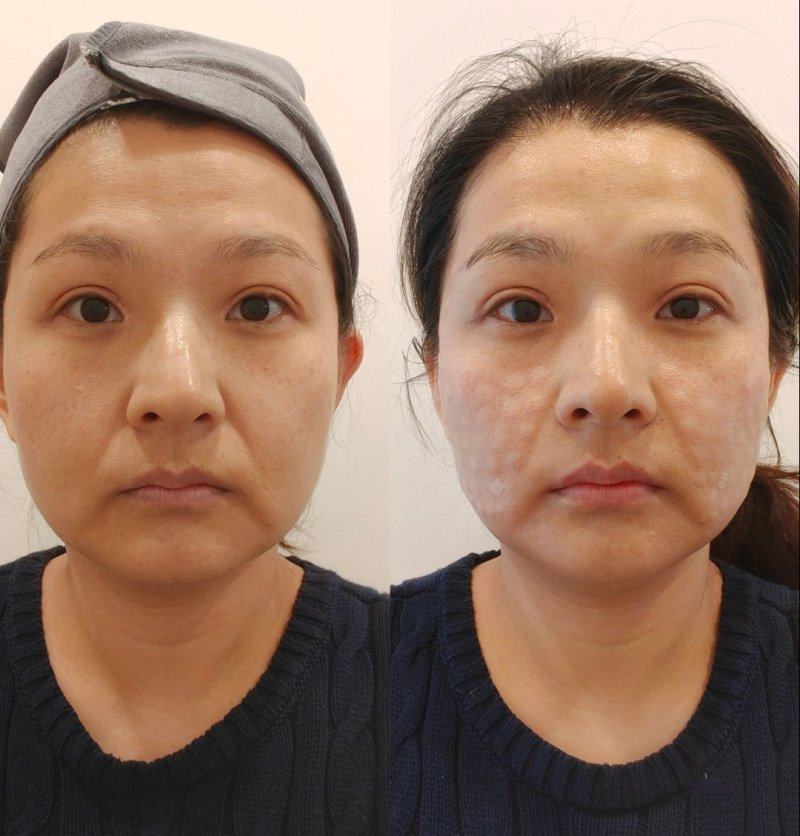 雷波美枢整形医院真人口碑评价怎么样？