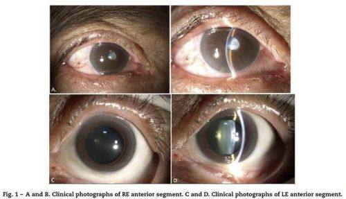 上海新视界眼科医院（中兴整形院区）是正规医院吗？