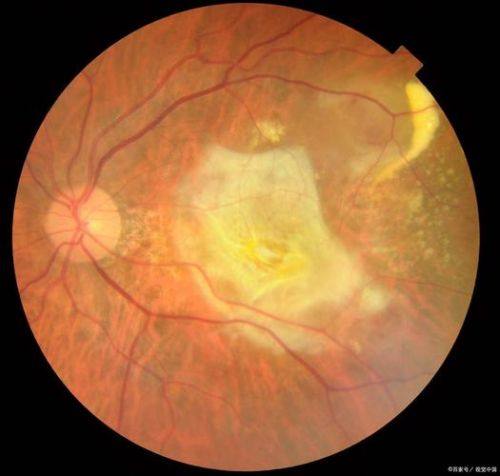 上海新视界眼科医院（中兴整形院区）特色项目及技术优势