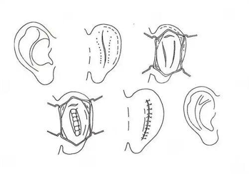 郑州中韩顺美眼鼻整形美容机构是正规医院吗?