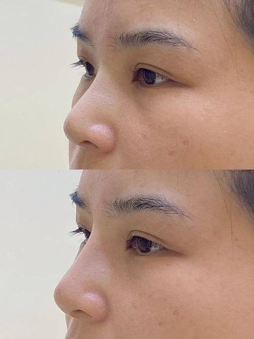 郑州中韩顺美眼鼻整形美容机构地址电话营业时间