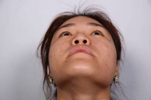 郑州中韩顺美眼鼻整形美容机构特色项目及技术优势