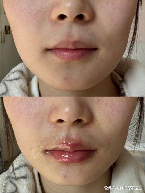 郑州中韩顺美眼鼻整形美容机构真人口碑评价怎么样?