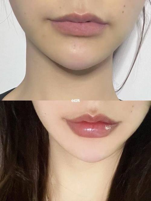 郑州中韩顺美眼鼻整形美容机构收费价格表/收费标准